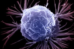 Британские ученые нашли способ бороться с раком